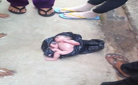 نوزادی که از درون سطل زباله زنده پیدا شد + تصاویر