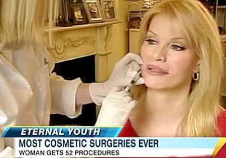 زنی با رکورد جراحی زیبایی به چهره دلخواهش رسید (عکس)