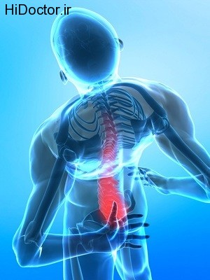 lumbar-spine-disc-herniation